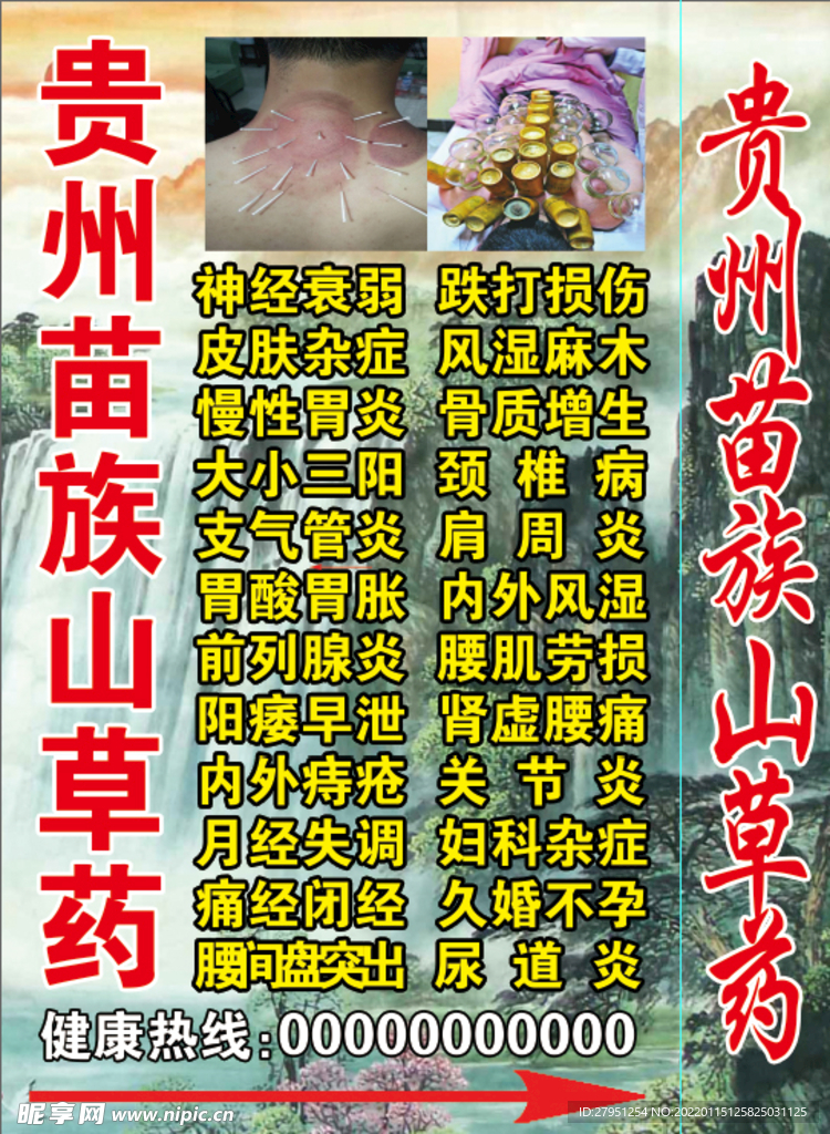 苗族山草药 秘方 偏方 灯箱