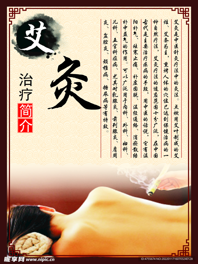 艾灸