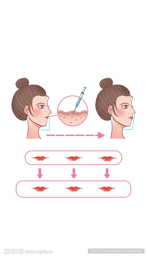 扁平女性医疗美容微整形唇部丰唇
