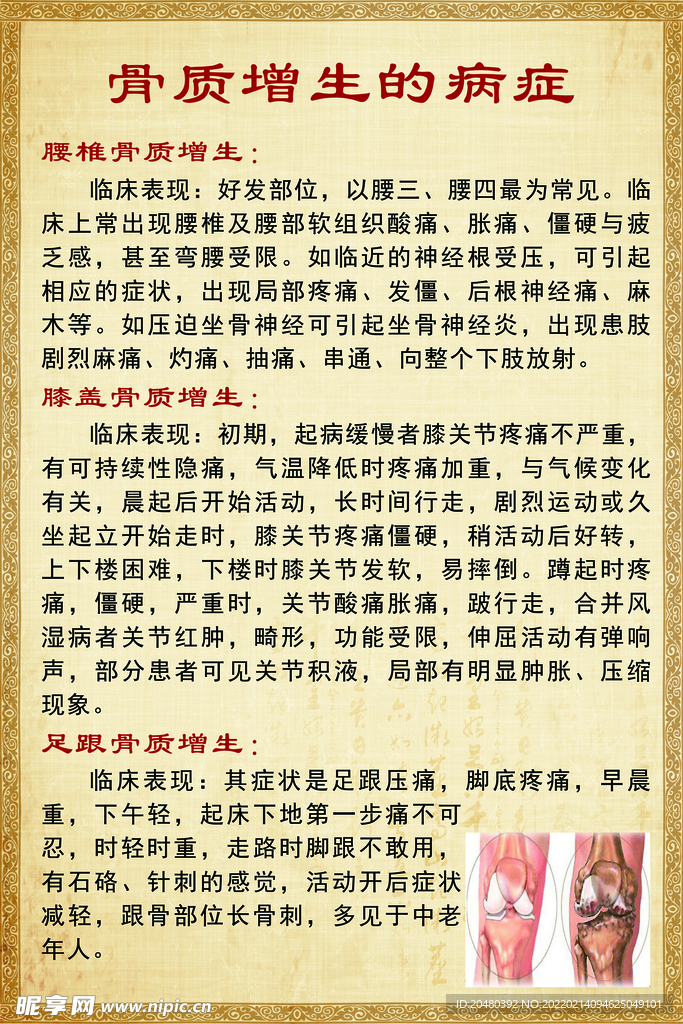 骨质增生的病症