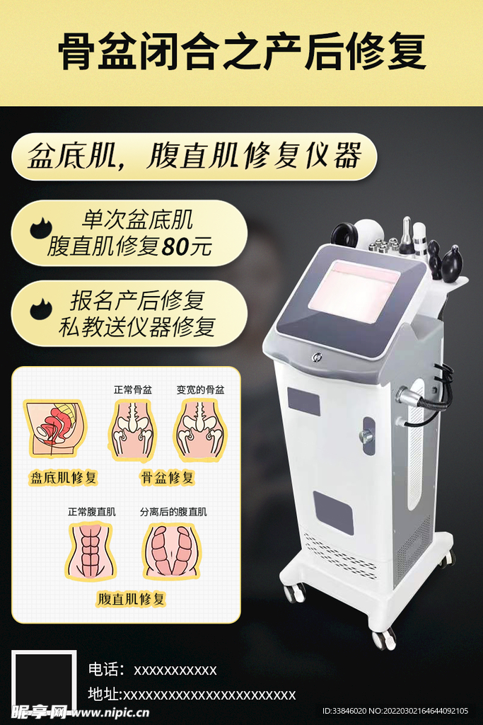 骨盆闭合之产后修复