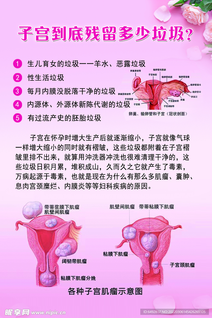 子宫肌瘤