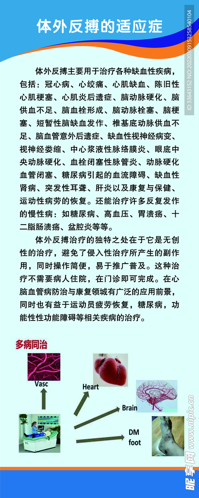 体外反搏的适应症易拉宝展架