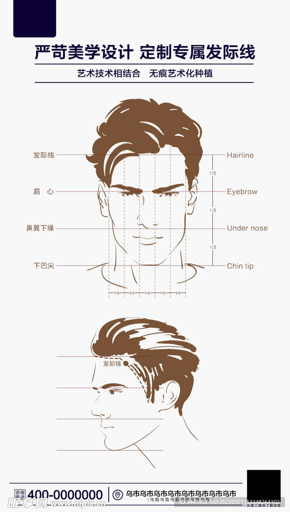 植发  男士发际线