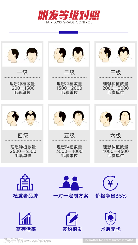 脱发