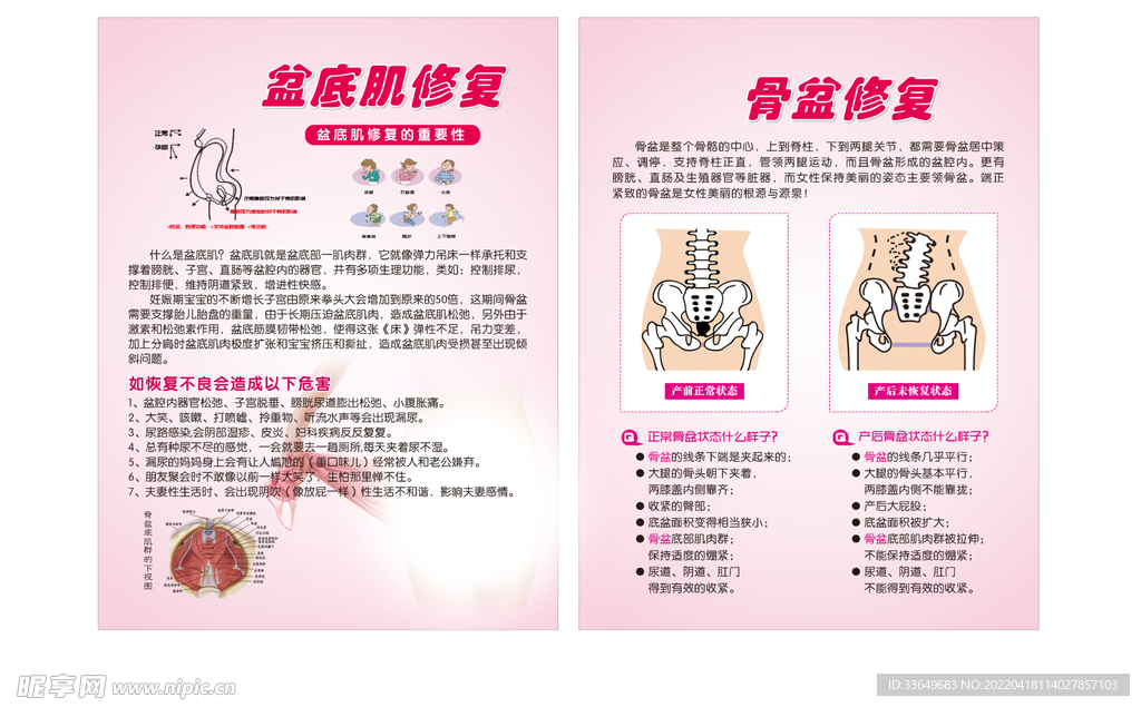 盆底肌修复骨盆修复