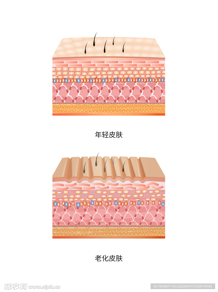 皮肤示意图年轻化与老年化对比