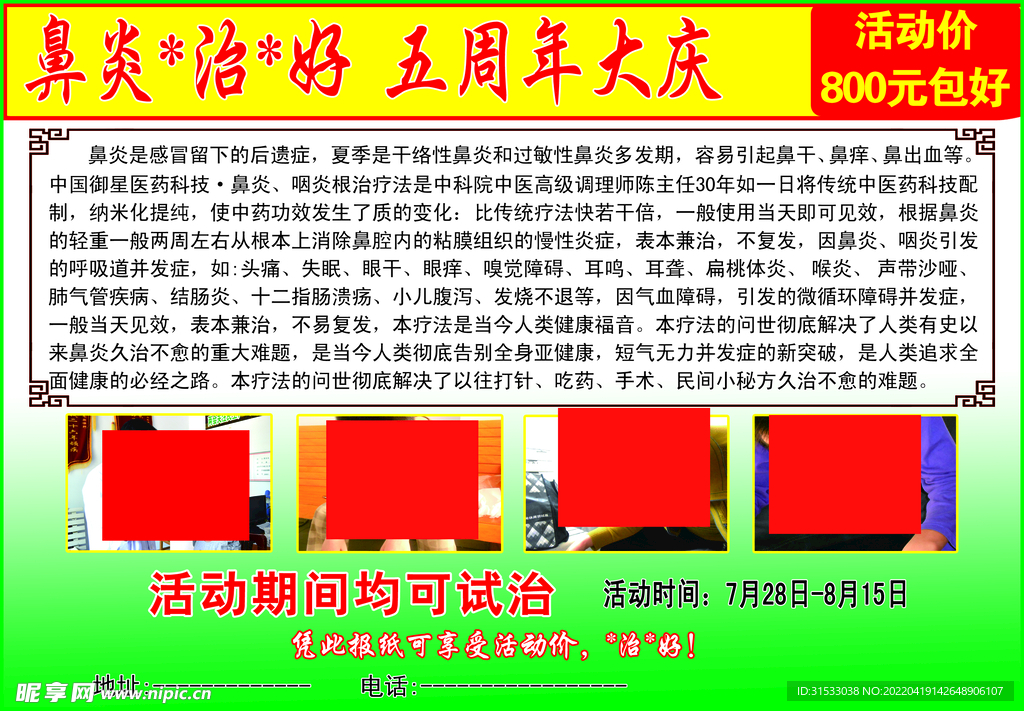 鼻炎