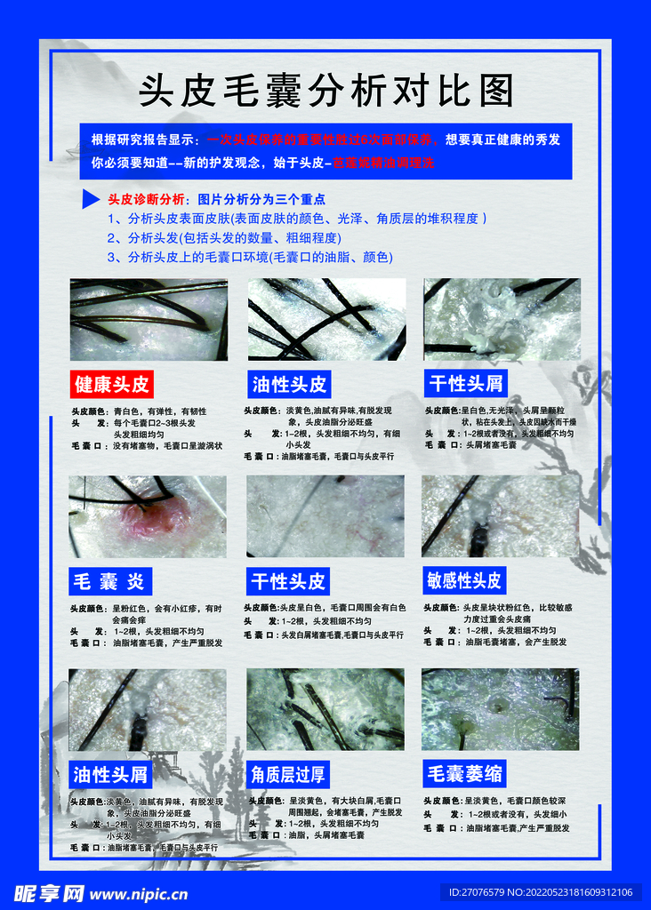 头皮毛囊分析对比图