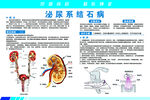 结石病科普海报