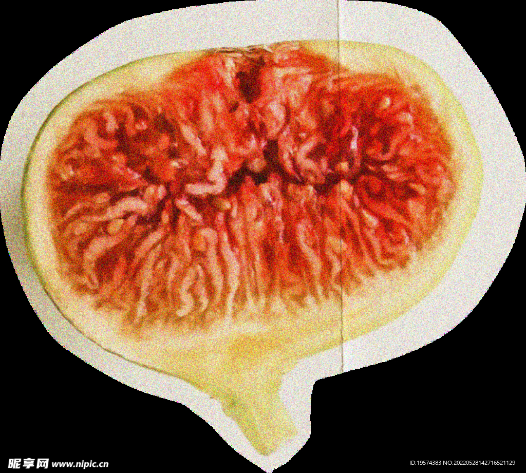 无花果横截面