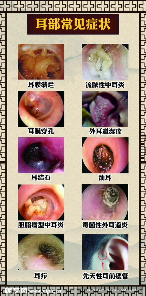 耳部症状