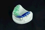 牙科模型牙齿矫正器矫治器
