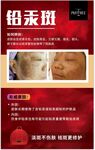 花皙面部美容铅汞斑图片