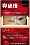 花皙面部美容真皮斑图片