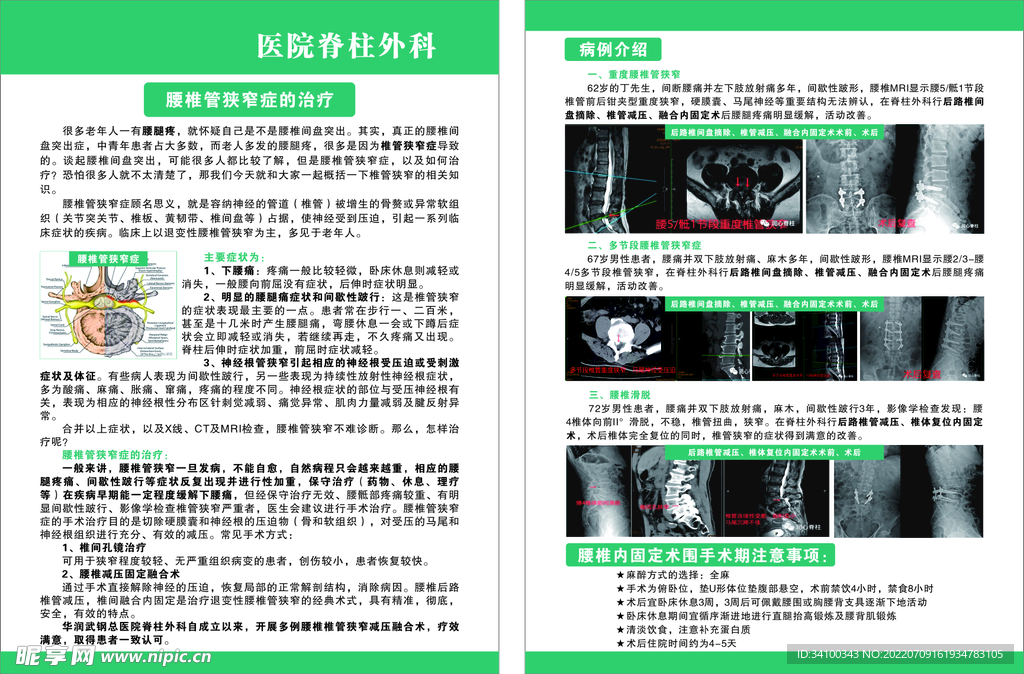 骨科医院宣传