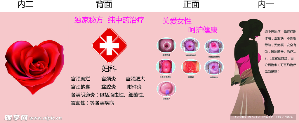 宫颈包装展开图