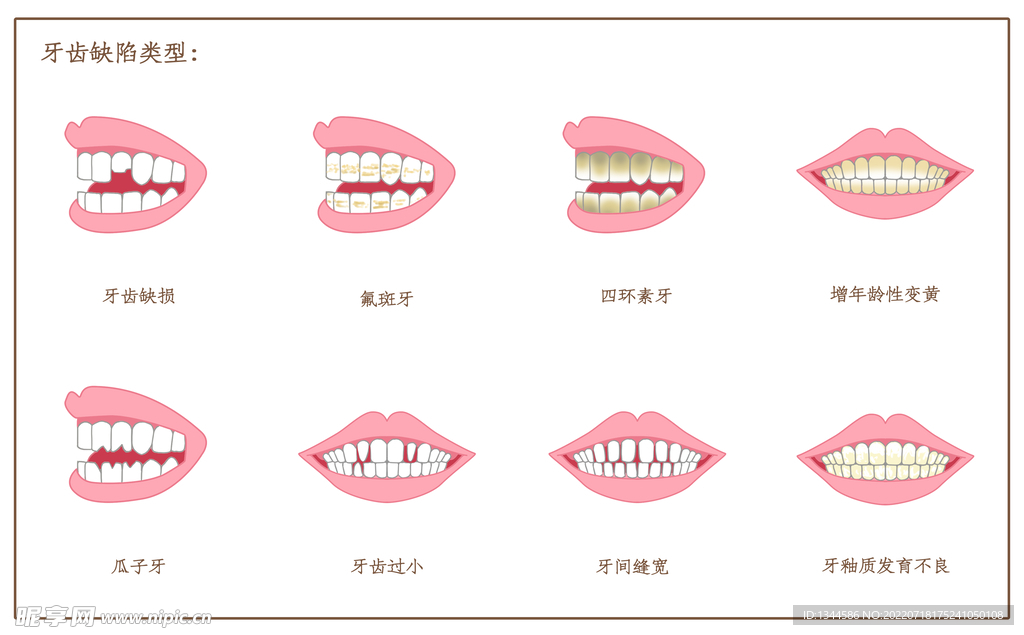 牙齿缺陷