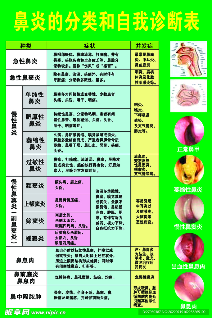 鼻炎自我诊断表