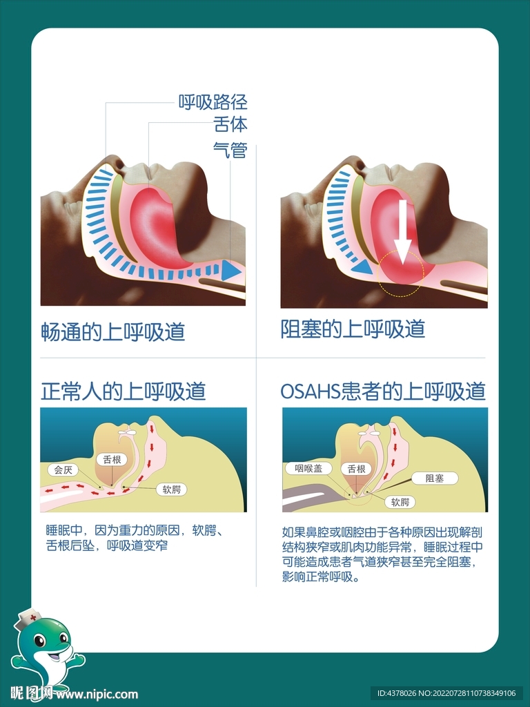 呼吸道海报