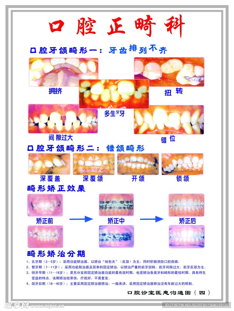 口腔正畸科展板