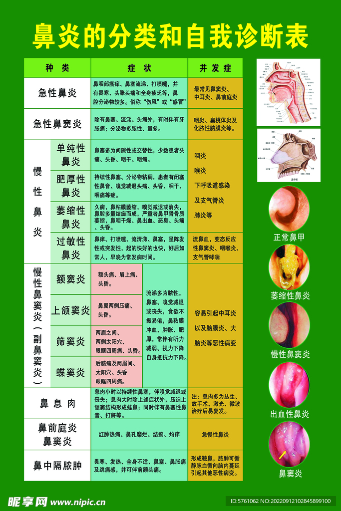 鼻炎的分类和自我诊断表