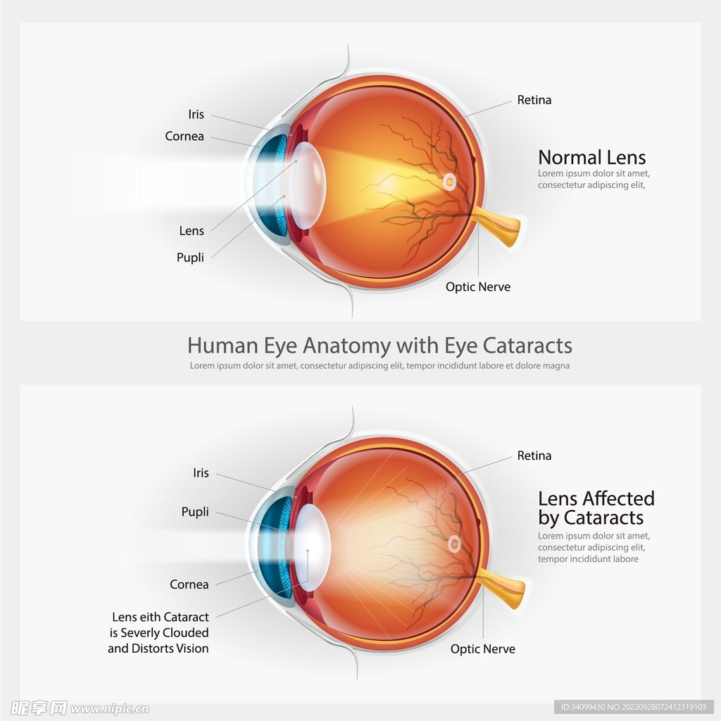 眼球结构