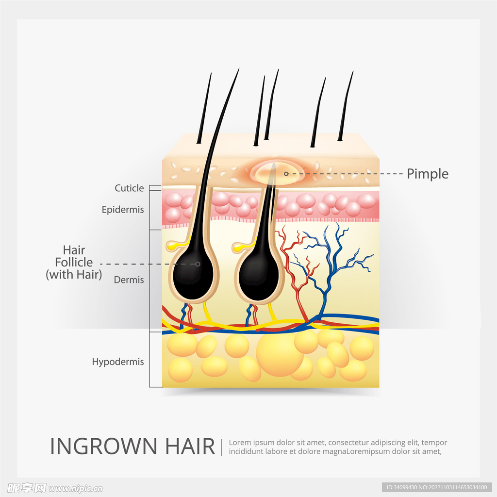 用什么可以刺激头发毛囊重焕生机？如何使自己的头发变得浓密？ - 知乎