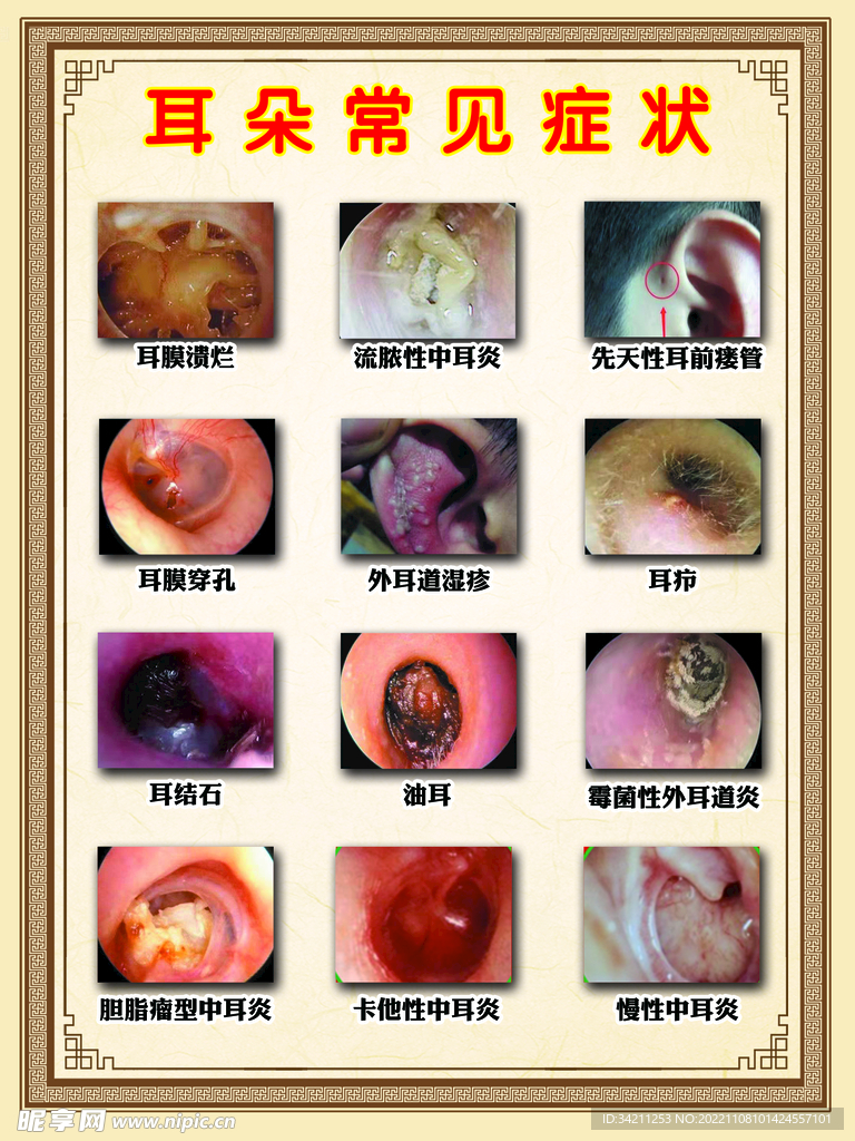 耳朵常见症状