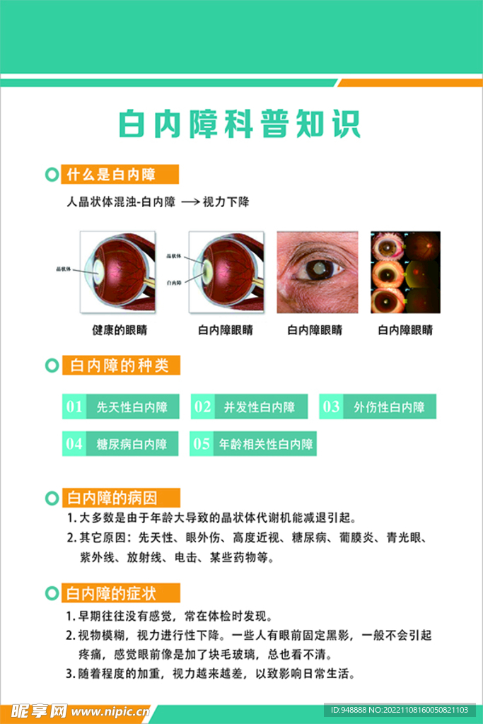 白内障科普知识