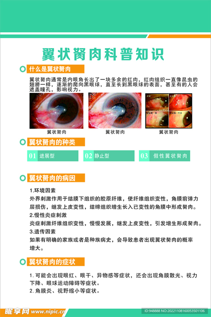 翼状胬肉科普知识