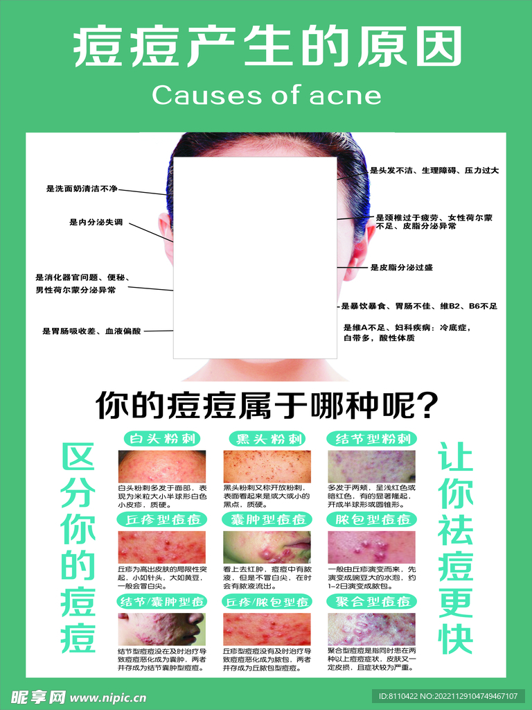 痘痘产生的原因