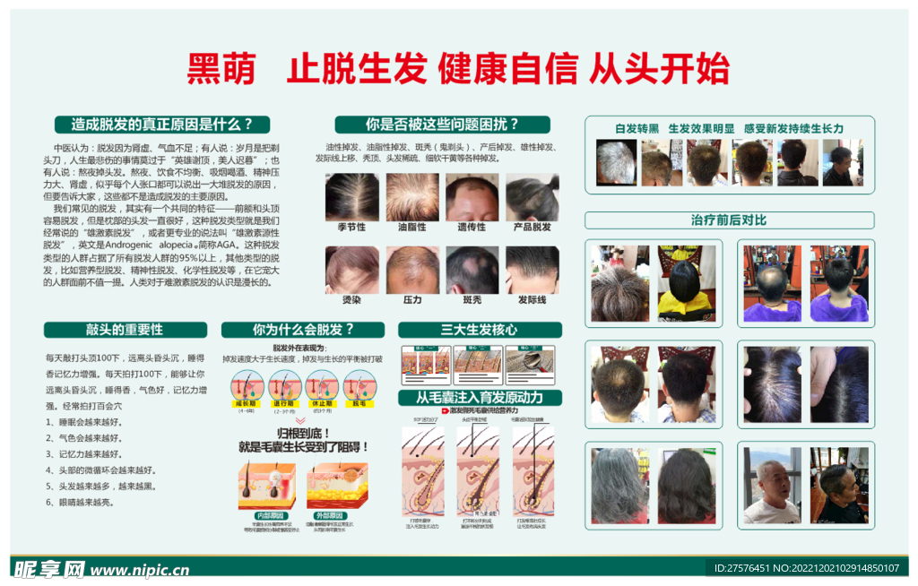 治疗脱发广告