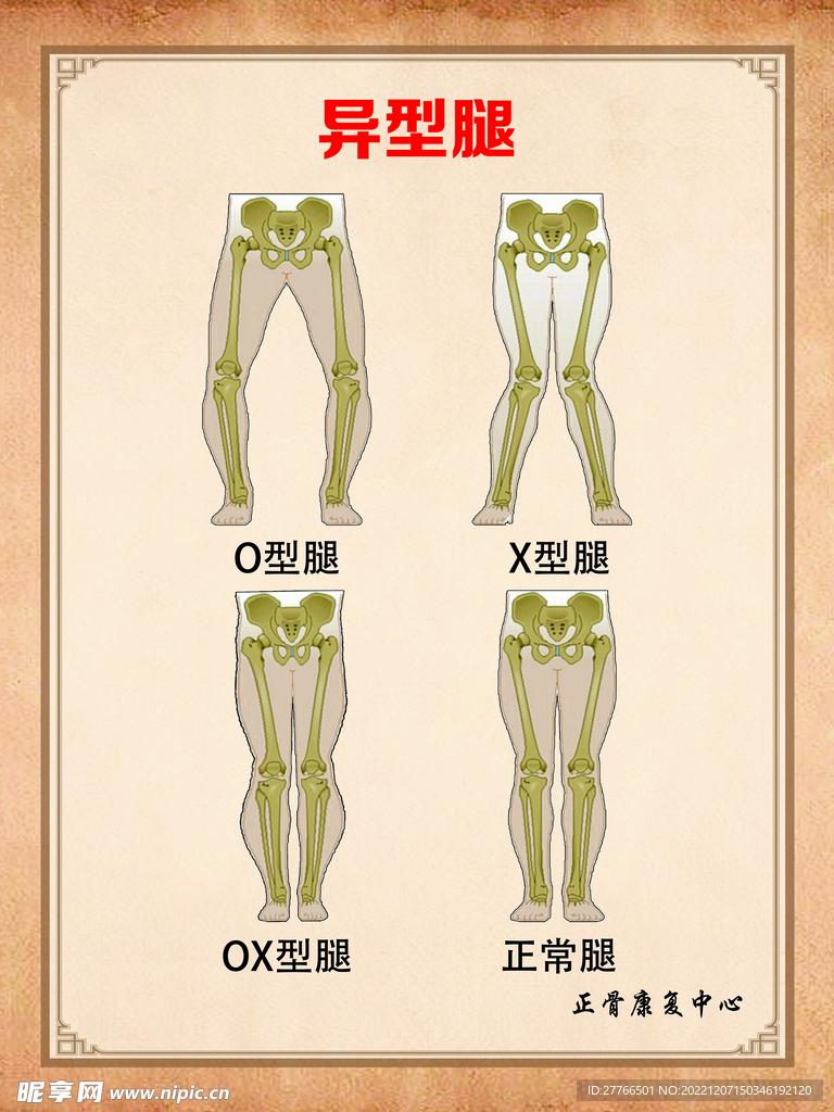 正骨海报