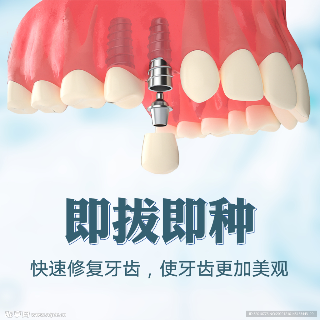 即拔即种