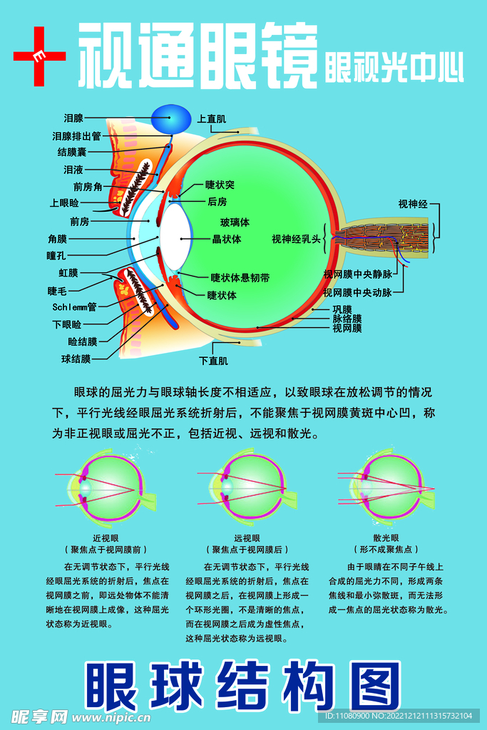 眼球结构图