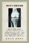 膝关节X线像结构示意图