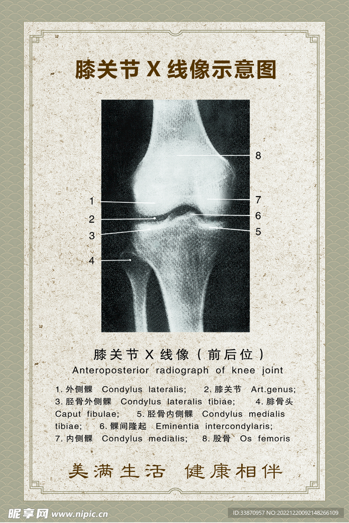 膝关节X线像结构示意图