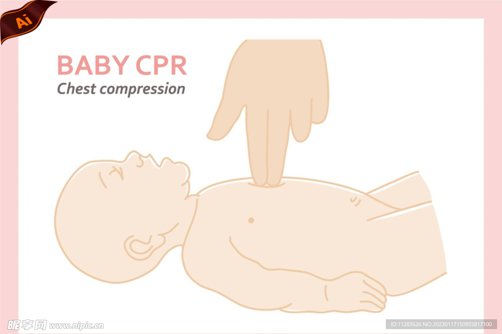 婴儿CPR