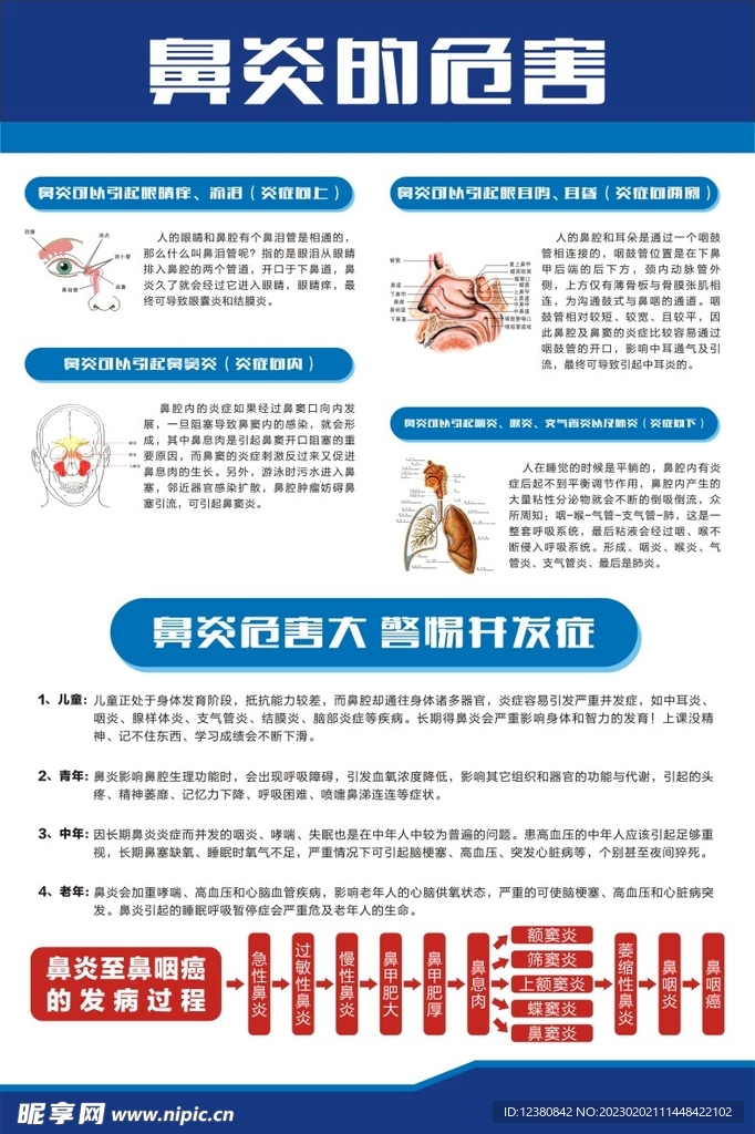 鼻炎