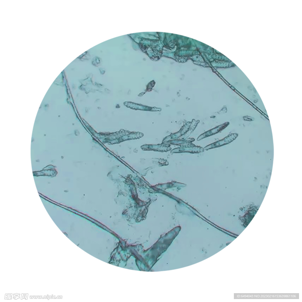 螨虫尘螨分泌物显微镜