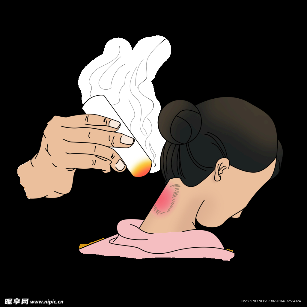 艾灸图片