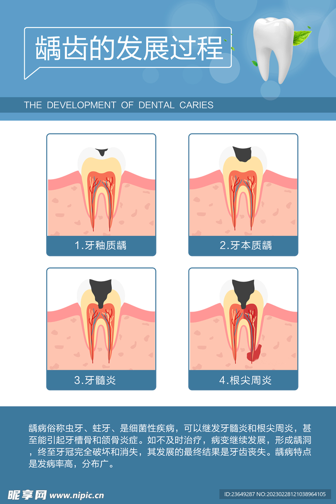 龋齿的发展过程