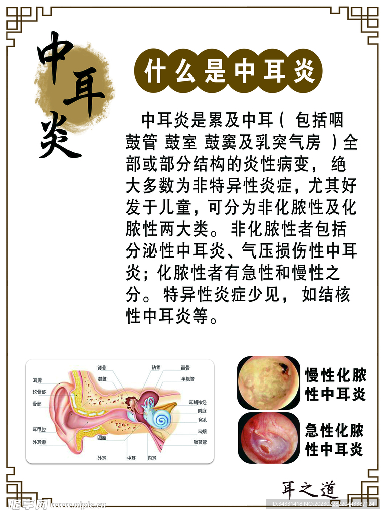 中医文化 中医科普 中耳炎