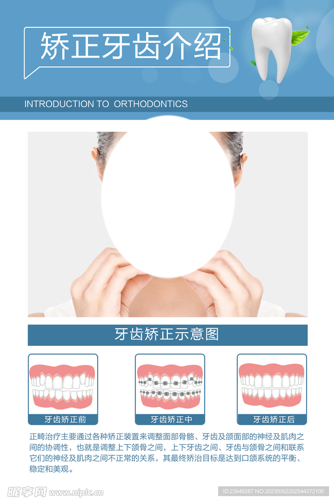 矫正牙齿介绍