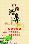 鼻炎