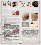 拔罐艾灸 