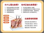 超市去角质店教立牌