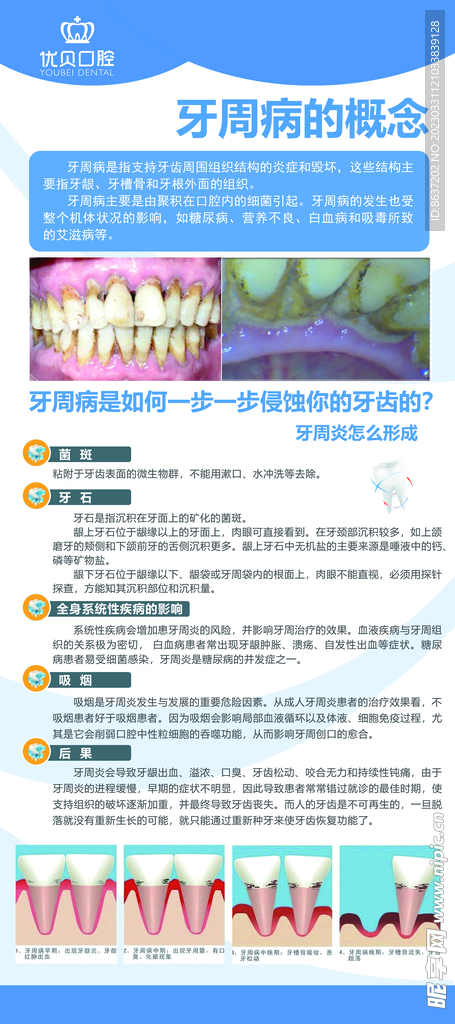 口腔易拉宝