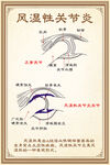 中医海报 风湿性关节炎